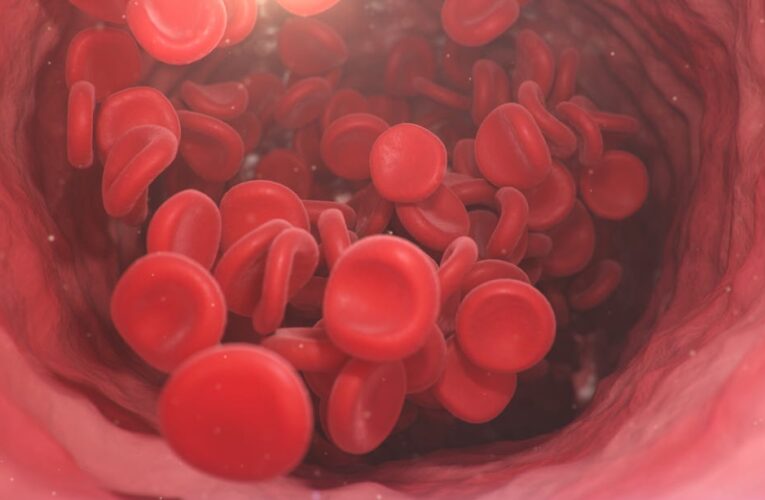 Does Your Blood Type Affect Your Heart Health? Yes, but Here’s the Full Story     – CNET